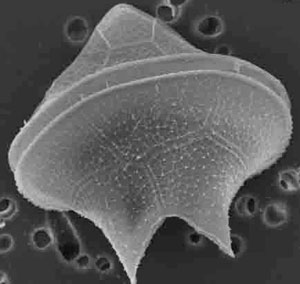 scanning electron microscope image of phytoplankton