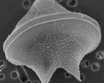 enlarged image of phytoplankton